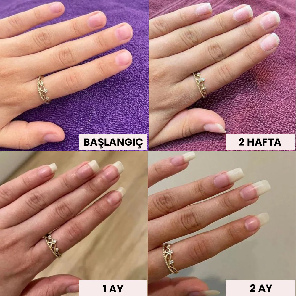Nailorya™ Tırnak Bakım Kalemi