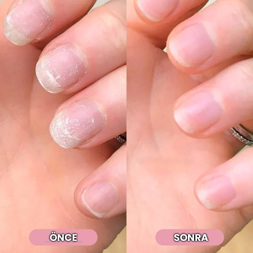 Nailorya™ Tırnak Bakım Kalemi