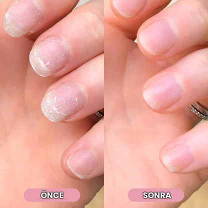 Nailorya™ Tırnak Bakım Kalemi