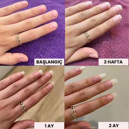 Nailorya™ Tırnak Bakım Kalemi